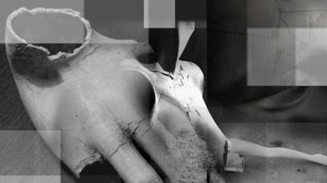 foto ilustrasi mutilasi 