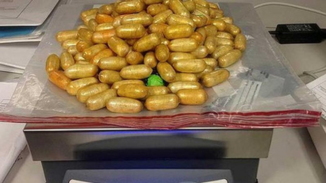Heroin yang berhasil dikeluarkan dari lambung Bola Adebisi