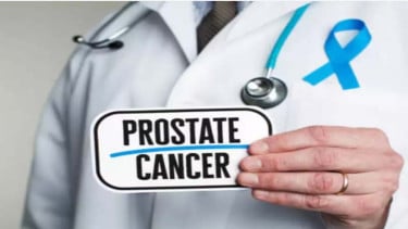 Kanker Prostat