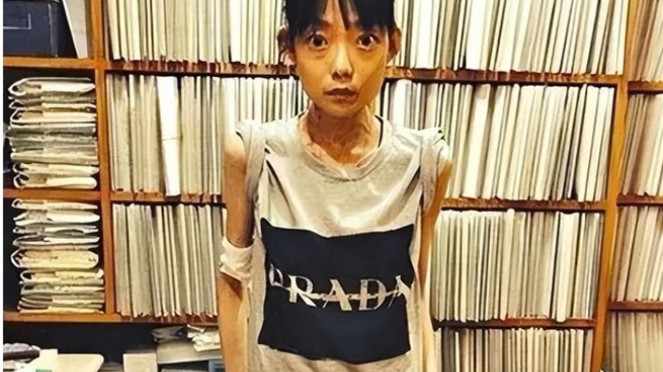 Connie Ng dengan berat 22 Kg