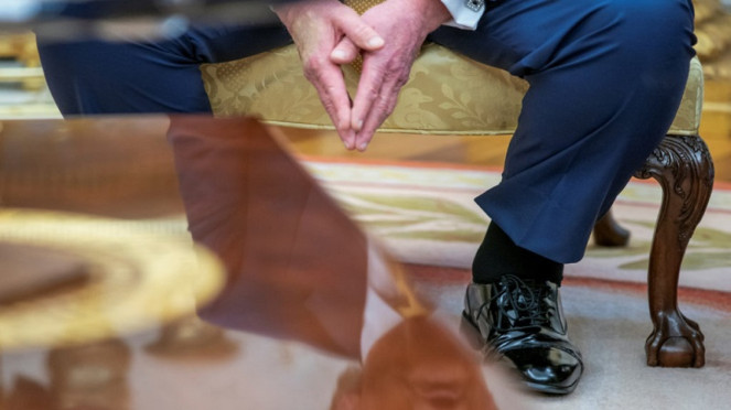 Kondisi kesehatan Presiden AS Donald Trump tengah disorot -- kaki membengkak