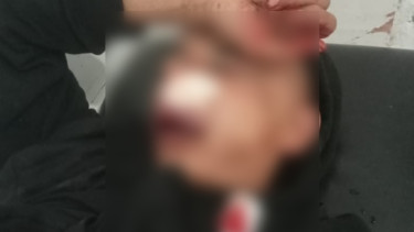 Claudius, Pemuda NTT Diduga Disiksa Sejumlah Polisi Selama Dua Jam di Polres
