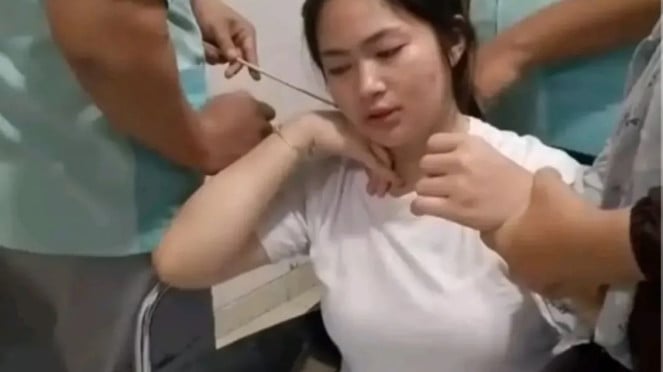 Tawuran di Kota Makassar menyebabkan remaja wanita terkena busur panah