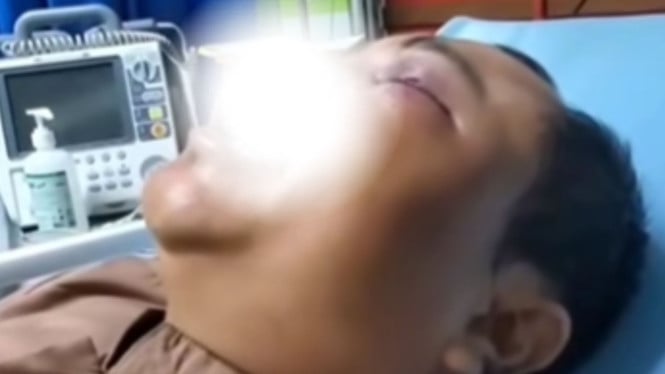 Anggota Banser Ngaku Dianiaya saat Hadir Maulid, Tuding Habib Bahar Terlibat