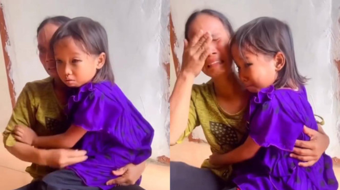 Miris! Siswi SD Pulang Sekolah dengan Mata Lebam dan Pembuluh Darah Pecah