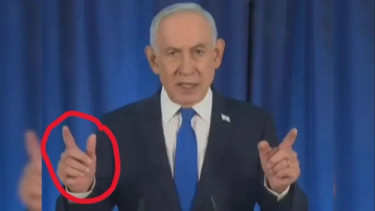 Penampakan Jari tangan kanan Netanyahu jadi sorotan
