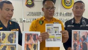 Kepala RS Bhayangkara Moh Hasan Palembang Kombes Pol Budi Susanto