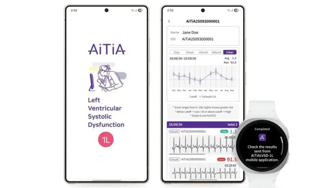 Samsung Perkenalkan Fitur Canggih LVSD di Smartwatch, Apa Itu dan Bagaimana Manfaatnya?, Bagaimana Teknologi LVSD Bekerja?, Inovasi Lainnya: Pemantau Gelombang Otak, Kapan Fitur Ini Akan Hadir?, Kesimpulan: