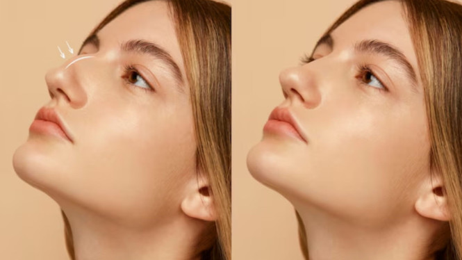 Ilustrasi Countour Hidung Jadi Mancung, 1. Menggunakan Warna Terlalu Gelap, 2. Membuat Tidak Sesuai Bentuk Hidung, 3. Tidak Memperhatikan Pencahayaan saat Mengaplikasikan, 4. Mengabaikan Blending, 5. Melupakan Peran Highlighter, 1. Kenali Bentuk Hidung, 2. Gunakan Produk yang Tepat, 3. Blending dengan Teknik yang Benar, 4. Gunakan Sedikit Produk, 5. Seimbangkan dengan Makeup Keseluruhan