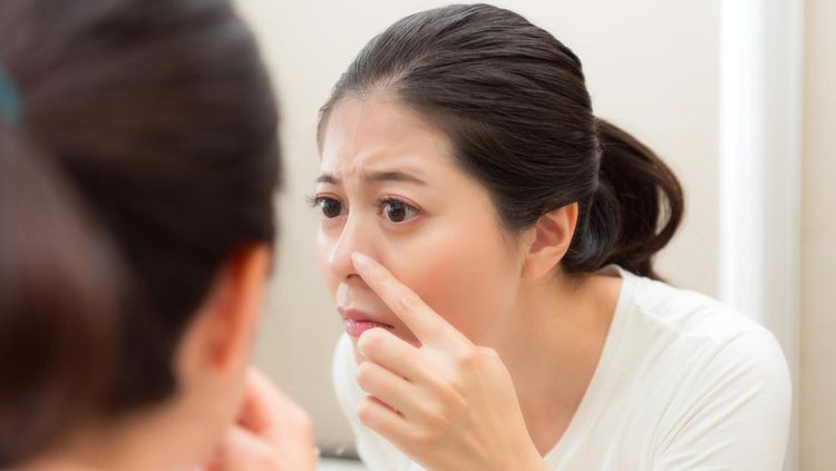 Ilustrasi jerawat hidung, Mitos jerawat ada yang kangen, Penyebab jerawat muncul, Cara menghilangkan jerawat di rumah, Kandungan obat yang ampuh menghilangkan jerawat