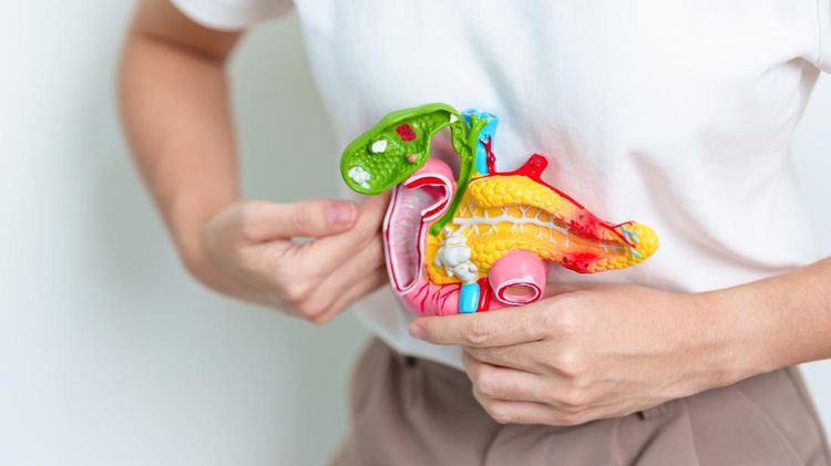 Woman holding human Pancreatitis anatomy model with Pancreas, Gallbladder, Bile Duct, Duodenum, Small intestine. Pancreatic cancer, Acute and Chronic pancreatitis, Digestive system and Health concept