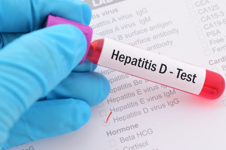 Hepatitis, World Hepatitis Day, Hari Hepatitis Sedunia, hepatitis, Hepatitis adalah, hepatitis adalah, world hepatitis day, hari hepatitis sedunia 2025, hari hepatitis sedunia 28 Juli, tema hari hepatitis sedunia 2025, Hari Hepatitis Sedunia 28 Juli 2025, Ini Fakta dan Cara Memperingatinya
