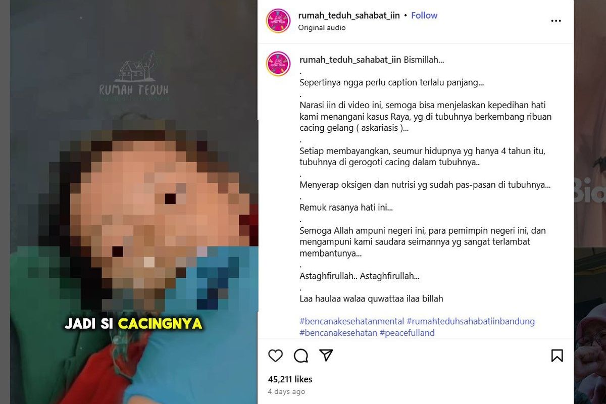 Dedi Mulyadi, Gubernur Jawa Barat, infeksi cacing, bocah sukabumi raya, bocah sukabumi raya meninggal cacing, Kisah Pilu Raya, Balita Sukabumi Meninggal Penuh Cacing, Dedi Mulyadi Akan Sanksi Desa