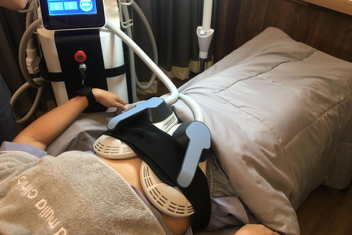 mengecilkan lingkar perut, Eva Mulia, cryo slimming, berapa lama hasil cryo slimming bertahan, cryo slimming before and after, cara mempertahankan hasil cryo slimming, cryo slimming reviews, lingkar paha, Apa Hasil Cyro Slimming Pro Bisa Tahan Lama? Ini Kata Dokter
