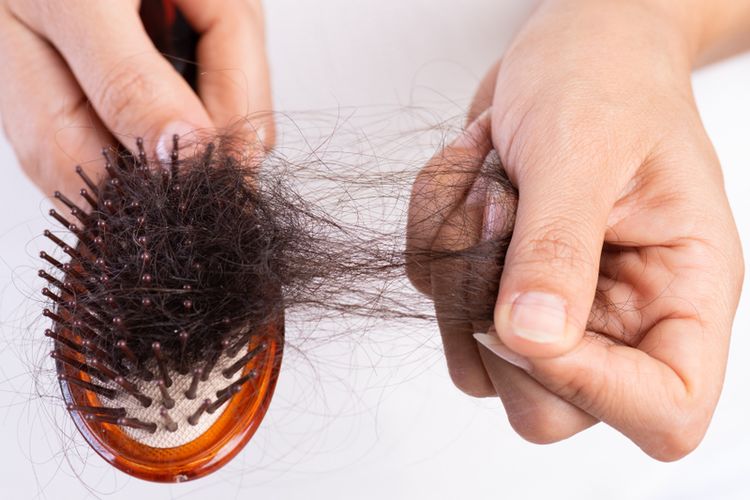 rambut rontok, obat rambut rontok, obat mengatasi rambut rontok, obat mengatasi kerontokan, obat kerontokan rambut, obat mencegah kerontokan rambut, Obat Rambut Rontok Ini Harus Terus Diminum dalam Jangka Panjang? Ini Kata Dokter