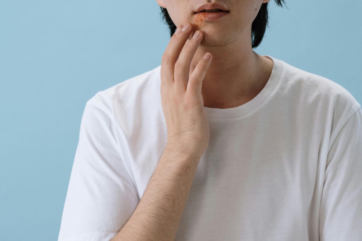 Stevens Johnson Syndrome, Jokowi, Gejala Stevens Johnson Syndrome, gejala Stevens Johnson Syndrome, Ini Gejala Stevens Johnson Syndrome yang Terlihat di Kulit, Terlihat dari Munculnya Ruam
