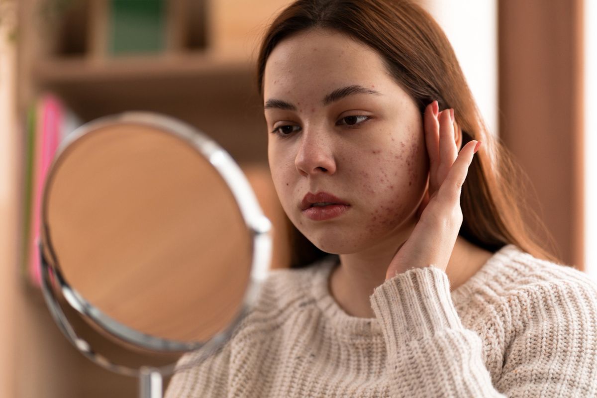 krim pemutih, Hiperpigmentasi, penyebab hiperpigmentasi, hiperpigmentasi, flek hitam di wajah, Dokter Kulit Ingatkan Bahaya Pakai Krim Pemutih Abal-abal untuk Flek Hitam
