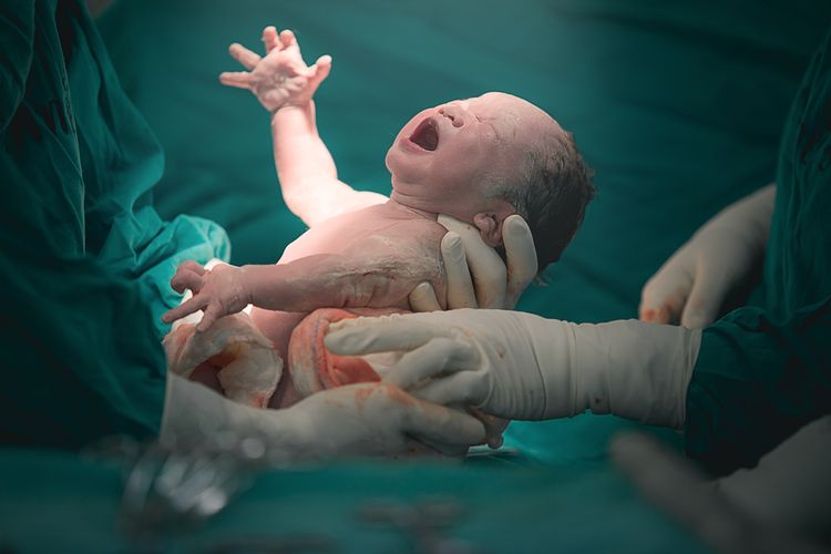 inversio uteri, rahim copot, dukun beranak, paraji, kasus rahim copot di garut, kasus rahim copot, Rahim Copot, Salah Satu Risiko Melahirkan di Dukun Beranak