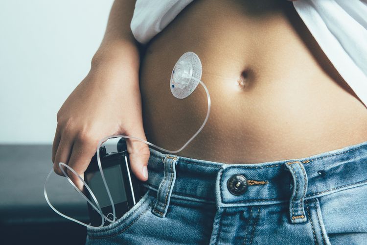 insulin, diabetes, dosis insulin, Dokter Ungkap Pengguna Insulin Lebih Berisiko Saat Puasa, Dosis Perlu Disesuaikan, Mengapa pengguna insulin lebih berisiko?, Dosis insulin perlu disesuaikan, Konsultasi sebelum memulai puasa, Keselamatan tetap jadi prioritas