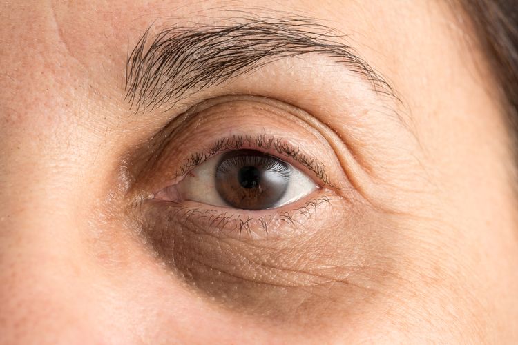 tanda penuaan, garis halus, eye cream, Banyak Orang Masih Salah Pakai Eye Cream, Dokter Kulit Ungkap Caranya