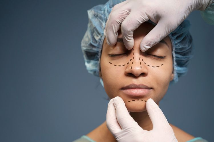 operasi plastik, rhinoplasty, Jenis operasi plastik hidung, Rhinoplasty, Operasi plastik, operasi hidung, operasi hidung rhinoplasty, jenis operasi hidung, jenis operasi plastik hidung, operasi plastik hidung, operasi plastik hidung mancung, 3 Jenis Operasi Plastik Hidung, dari Silikon hingga Tulang Rawan