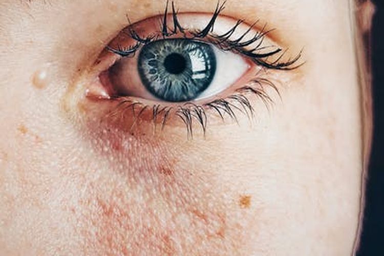 skincare, vitamin c, retinol, Flek hitam, hiperpigmentasi, kandungan skincare, Salicylic Acid, skincare untuk flek hitam, kandungan skincare untuk flek hitam, menghilangkan flek hitam, skincare untuk menghilangkan flek hitam, cara menghilangkan flek hitam di wajah, 12 Kandungan Skincare untuk Flek Hitam, Ada Retinol, 1. Glycolic acid (asam glikolat), 2. Salicylic acid (asam salisilat), 3. Gluconolactone, 4. Retinol, 5. Niacinamide (Vitamin B3), 6. Hydrocortisone cream, 7. Vitamin C, 8. Tranexamic acid, 9. Kojic acid, 10. Hydrocolloid patches (plester jerawat), 11. Sunscreen (tabir surya), 12. Moisturizer (pelembap)