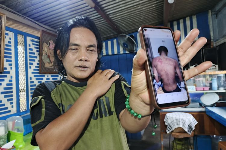 Undip, 4 Fakta Kasus Pengeroyokan Mahasiswa Undip, Berawal dari Tuduhan Pelecehan hingga Penyidikan, Korban dipancing datang ke kos-kosan, Ayah korban menyayangkan tak ada pihak kampus yang datang, Korban dilaporkan atas dugaan pelecehan seksual, Polisi sempat diminta tak proses hukum pengeroyok korban
