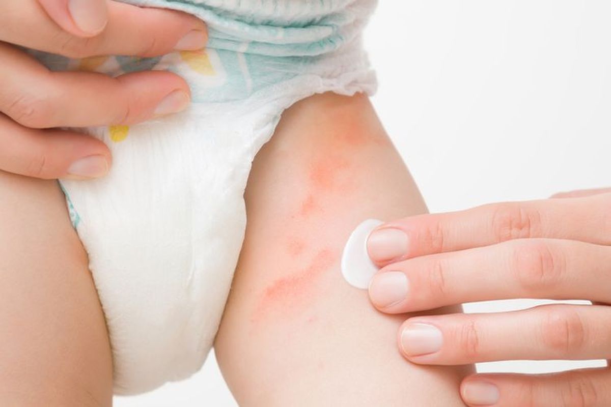 MAKUKU, Kenapa Kulit Bayi Mudah Mengalami Ruam Popok? Dokter Jelaskan Sebabnya, Memahami kondisi fisiologis kulit bayi yang lebih tipis, Risiko ruam akibat paparan kelembapan di area genital, Merawat ketahanan lapisan pelindung kulit, Inovasi serat sutra alami dan sarana edukasi di MAKUKU Land