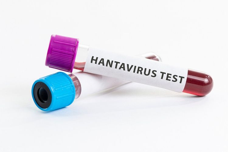 Wabah Hantavirus di Kapal Pesiar Mewah, 3 Orang Dilaporkan Meninggal