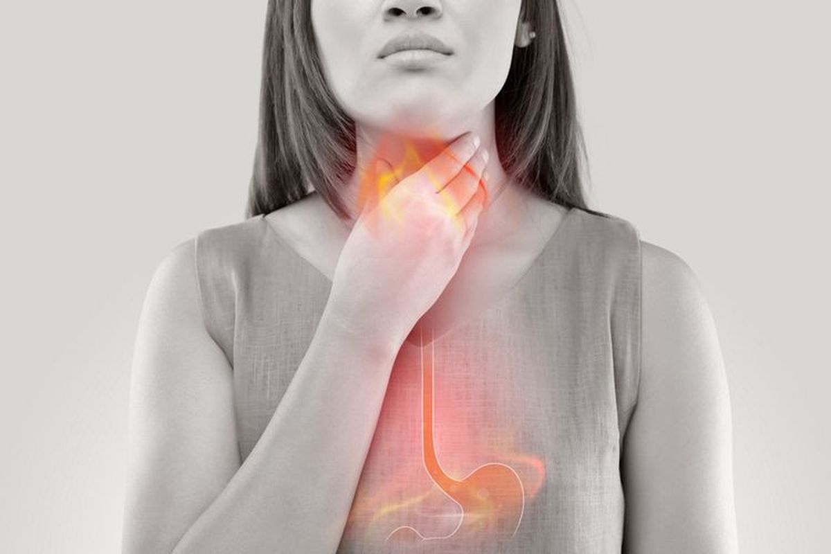 GERD, GERD adalah, gerd bisa sebabkan kematian mendadak, benarkah gerd bisa mati mendadak, Benarkah GERD Bisa Sebabkan Kematian Mendadak? Ini Penjelasan Dokter