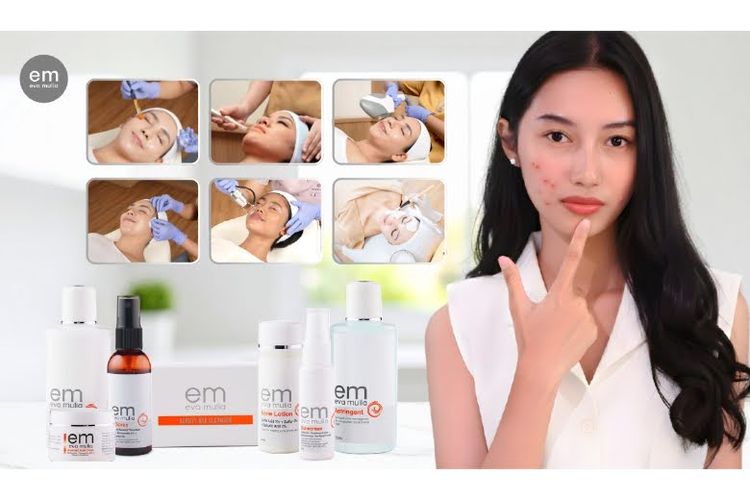treatment, jerawat, Eva Mulia Clinic, perawatan kulit, 5 Kesalahan Umum Saat Treatment Jerawat yang Justru Memperparah Kondisi Kulit