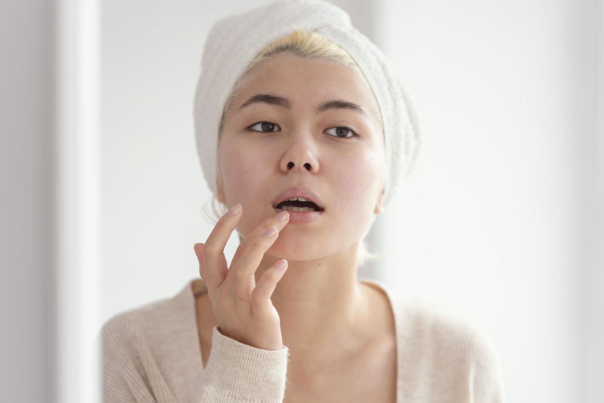 penyebab kulit kering, kesehatan kulit, Penyebab kulit kering, penyebab kulit kering di sekitar mulut, kulit kering di sekitar mulut, kenapa kulit kering mengelupas, Mengapa Kulit di Sekitar Bibir Sering Kering? Ini Penyebab Umumnya, 1. Iritasi dan alergi produk perawatan, 2. Faktor cuaca dan lingkungan, 3. Kebiasaan menjilat bibir, 4. Eksim (dermatitis atopik), 5. Infeksi kulit, 6. Kekurangan nutrisi, 7. Penggunaan skincare yang terlalu kuat
