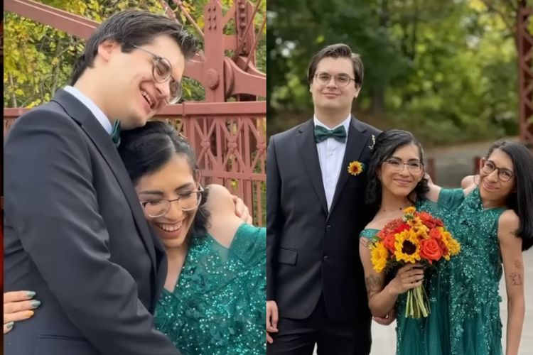 kembar siam, cerita cinta, kisah cinta, carmen andrade, lupita Andrade, kembar siam menikah, kembar siam lupita dan carmen, Kisah Nyata Kembar Siam Menikah, Carmen Andrade Temukan Cinta Sejati