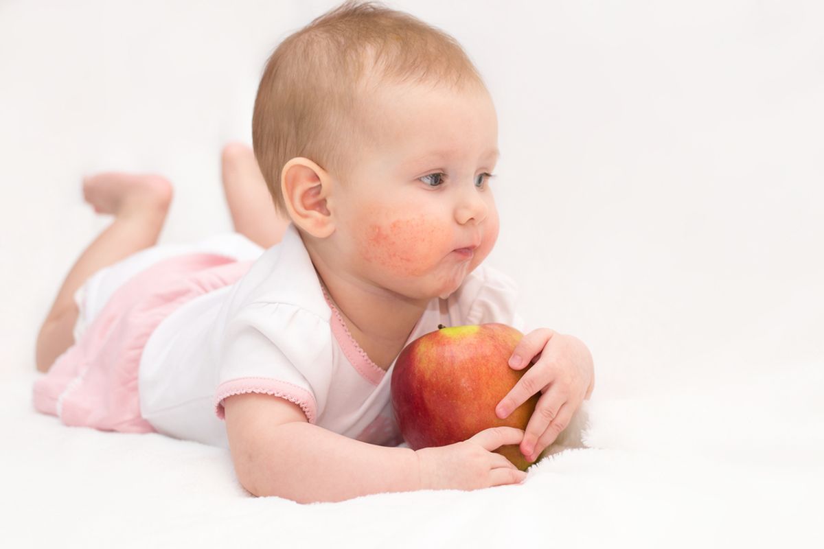 eksim, dermatitis atopik, Mustela, 3 Kesalahan Perawatan Kulit Eksim Anak yang Sering Tidak Disadari