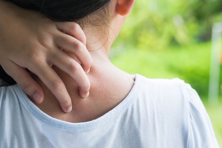 alergi, alergi pada anak, perbedaan alergi ringan dan berat, gejala alergi ringan, gejala alergi berat, tanda alergi pada anak, reaksi alergi pada anak, Beda Reaksi Alergi Ringan dan Berat pada Anak Menurut Dokter, Orangtua Wajib Tahu, Tanda alergi ringan pada anak, Tanda alergi berat pada anak, Waspadai pemicu dan kenali tanda awal alergi pada anak, Pencegahan tetap jadi kunci alergi pada anak