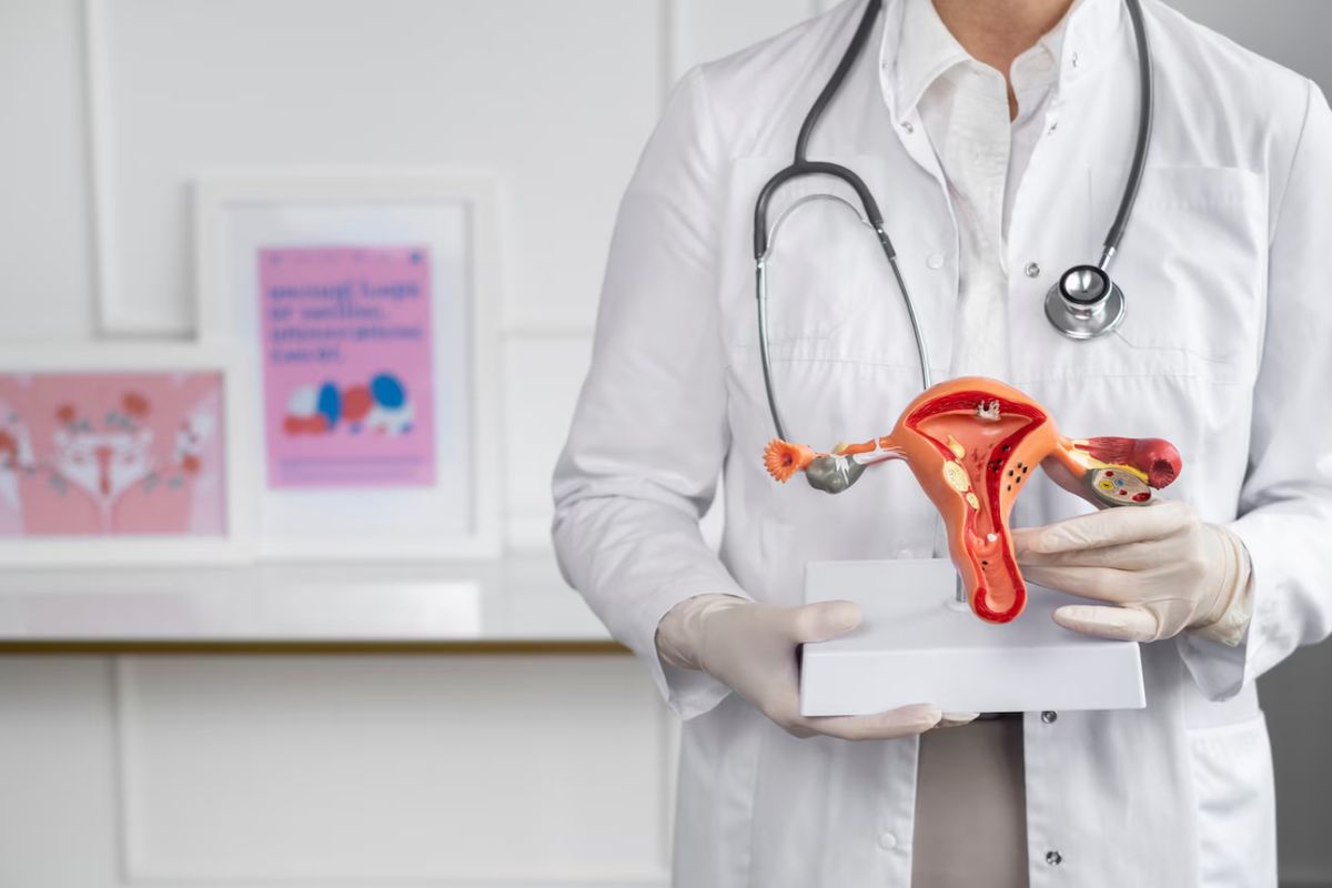 PCOS, Gejala PCOS, penyebab PCOS, PCOS adalah, Penyebab PCOS, apa itu pcos, Apa Itu PCOS? Ketahui Gejala dan Penyebabnya Menurut Dokter