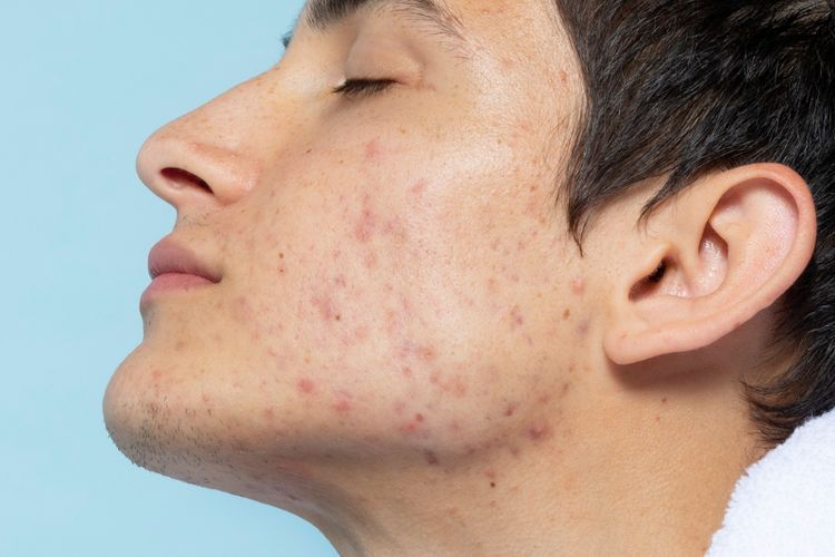 dokter, perawatan wajah pria, skincare pria, eva mulia cimone, cara merawat wajah pria, bagaimana cara merawat wajah dengan baik, kesalahan pria saat merawat wajah, tips merawat wajah pria, kulit wajah pria, Kesalahan Perawatan Wajah Pria yang Bikin Kulit Kusam Menurut Dokter