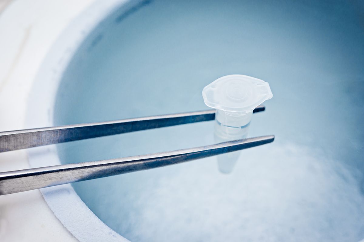 Egg freezing, pembekuan sel telur, Luna Maya, egg freezing, Luna Maya egg freezing, egg freezing adalah, risiko egg freezing, membekukan sel telur, Seperti yang Dilakukan Luna Maya, Apa Risiko Egg Freezing?