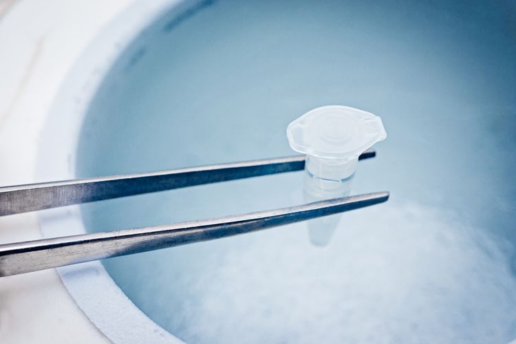 egg freezing, Sabrina Chairunnisa Jalani Egg Freezing, Berapa Usia Ideal Membekukan Sel Telur?