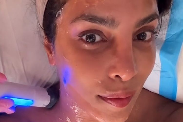 pengencangan kulit, Priyanka Chopra Jonas, Terapi Pengencangan Wajah Makin Canggih dan Minim Rasa Sakit