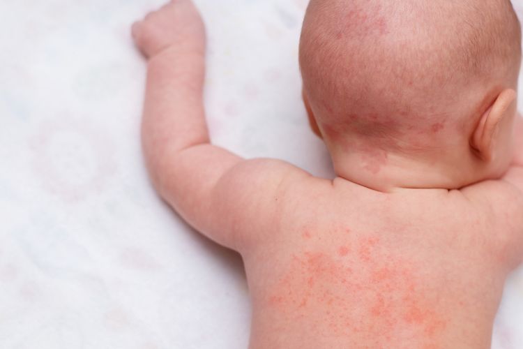 obat diare, obat demam, oximeter, pencegahan anak sakit, pertolongan pertama anak sakit, perlengkapan medis anak, pertolongan pertama anak, obat anak di rumah, 5 Perlengkapan Medis yang Wajib Ada di Rumah Saat Anak Mendadak Sakit, 1. Obat penurun panas, 2. Obat alergi, 3. Obat untuk diare, 4. Alat pengukur saturasi oksigen, 5. Termometer