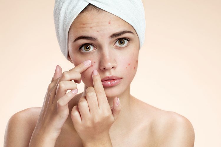 cara mencegah jerawat, basic skincare, dermatolog, tips skincare untuk kulit berjerawat, tips skincare yang benar, tips menjaga kulit yang berjerawat, tahapan skincare kulit berjerawat, bagaimana cara mencegah jerawat agar tidak muncul lagi, pencetus jerawat, basic skincare untuk jerawat, Cara Mencegah Jerawat agar Tidak Muncul Lagi, Tak Cuma Skincare, 1. Kenali pencetus jerawat, 2. Jaga kebersihan wajah dan lingkungan, 3. Hindari kebiasaan memencet jerawat, 4. Pola hidup sehat sebagai penunjang