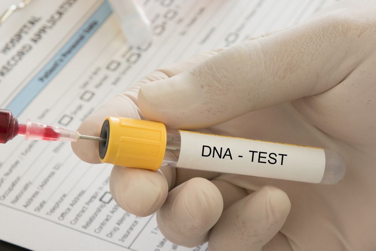 tes DNA, hasil tes DNA, harga tes DNA, biaya tes DNA, Berapa Biaya Tes DNA? Ini Perkiraan Harga dan Prosedurnya, Berapa Biaya Tes DNA di Indonesia?, Faktor yang Mempengaruhi Biaya Tes DNA, Prosedur Tes DNA, Berapa Lama Hasil Tes DNA Keluar?, Hal yang Perlu Diperhatikan Sebelum Tes DNA