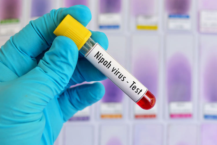 virus, virus Nipah, Surabaya, pencegahan, Gejala Virus Nipah Sulit Dikenali, Dokter Tegaskan Pentingnya Pemeriksaan Laboratorium
