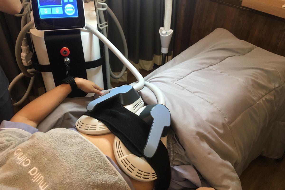 Mengecilkan perut, mengecilkan lingkar perut, mengecilkan lengan, dr eddy widjaja, treatment mengecilkan lingkar tubuh, cryo slimming treatment, cryo slimming, apa itu cryo slimming, bagaimana proses cryo slimming, mengecilkan lingkar lengan, Cryo Slimming Pro, Treatment untuk Mengecilkan Lingkar Perut Tanpa Operasi