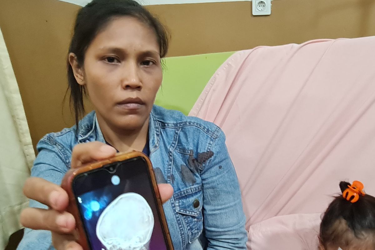 Medan, tawuran, Tragedi Peluru Nyasar di Medan, Bocah 4 Tahun Tertembak di Mata saat Ada Tawuran, Kronologi Kejadian di Jalan Stasiun, Kendala Biaya dan Penolakan BPJS, Penyelidikan Polisi dan Identitas Pelaku, Atensi Pemkot Medan
