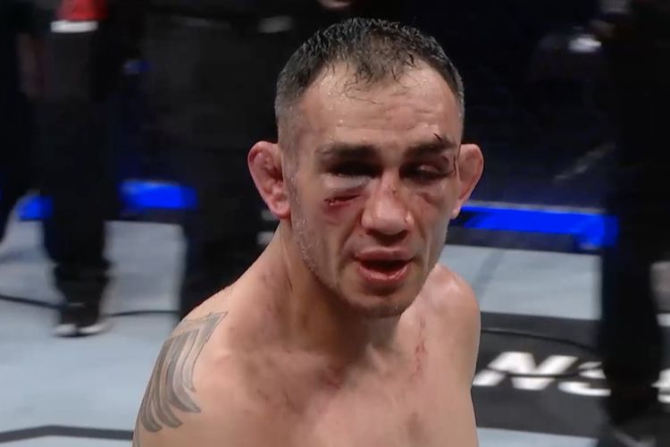 Khabib Nurmagomedov, Tony Ferguson, Tony Ferguson Ucap Lagi Sindiran 
