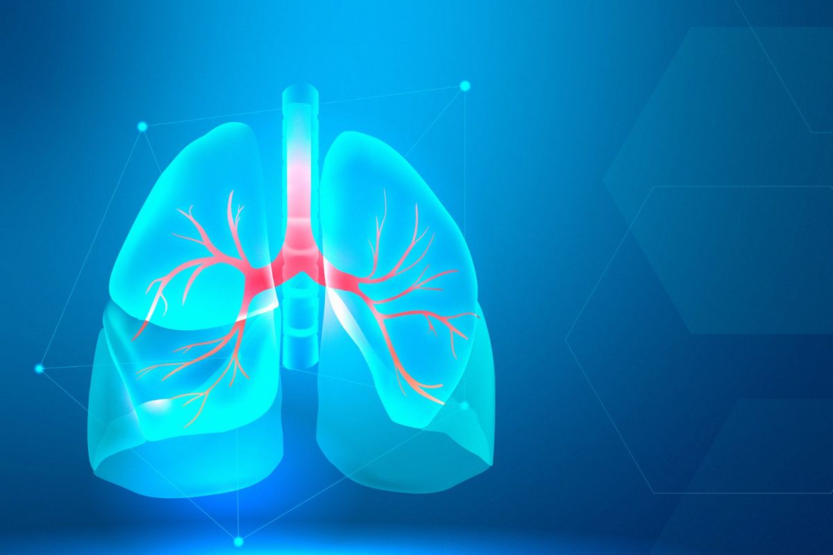 kanker paru, tumor di paru, VATS, Mengapa Tumor di Paru Sering Tak Disadari?