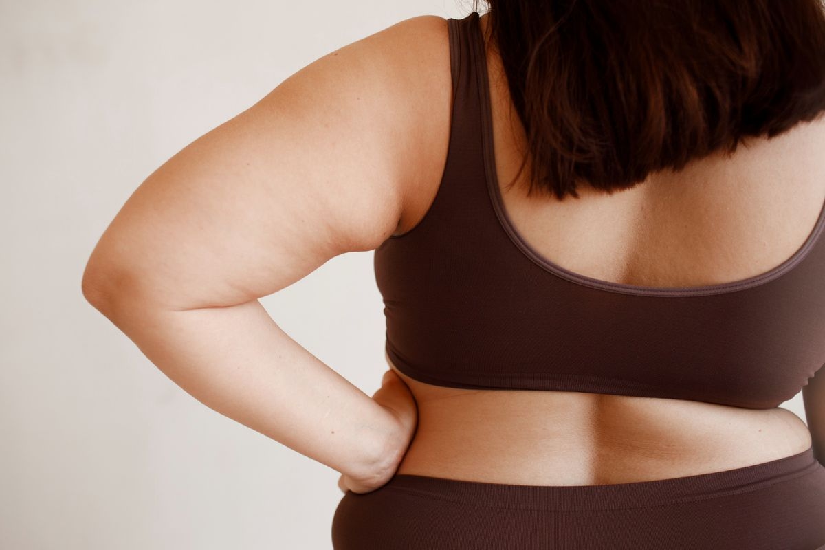 liposuction, sedot lemak, transfer lemak, Liposuction, generasi baru liposuction, Generasi Baru Liposuction, Sedot Lemak Sekaligus Transfer Lemak