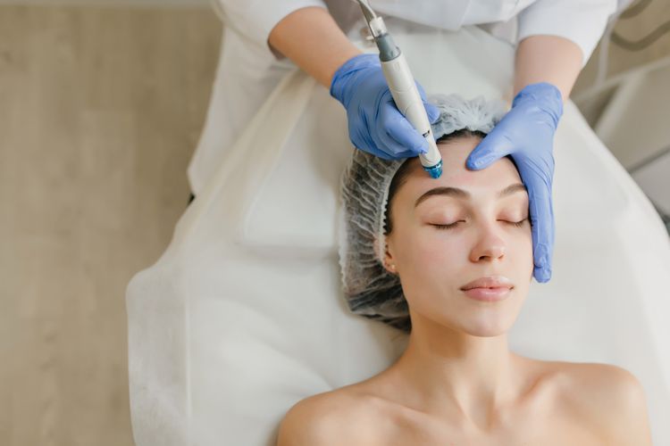treatment, Flek hitam, hiperpigmentasi, mengatasi flek hitam, flek hitam di wajah, flek hitam, mengatasi flek hitam di wajah, treatment untuk flek, treatment flek hitam, Daftar Treatment untuk Menghilangkan Flek Hitam di Wajah, Sudah Coba?, 1. Laser treatment , 2. Chemical peeling, 3. Cryosurgery, 4. Microdermabrasion